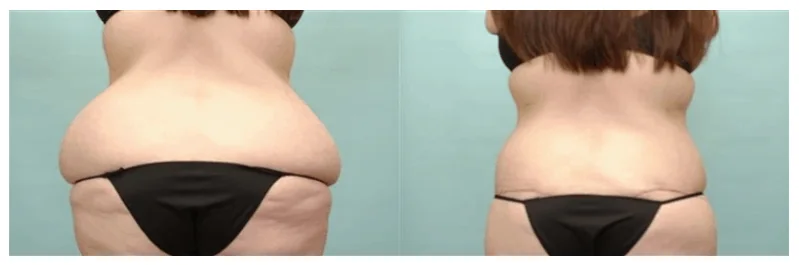 How to Achieve a Sculpted Waist