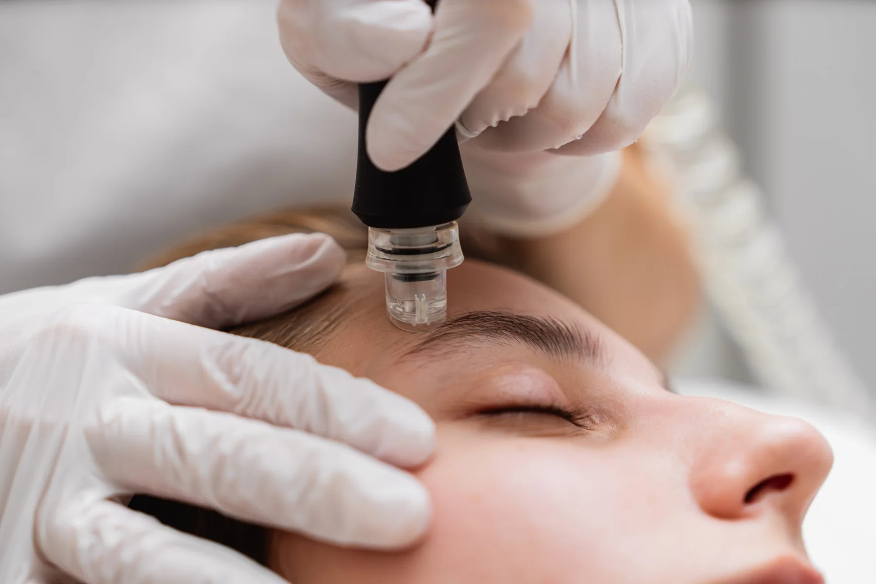 Young woman receiving microdermabrasion treatment on her face.