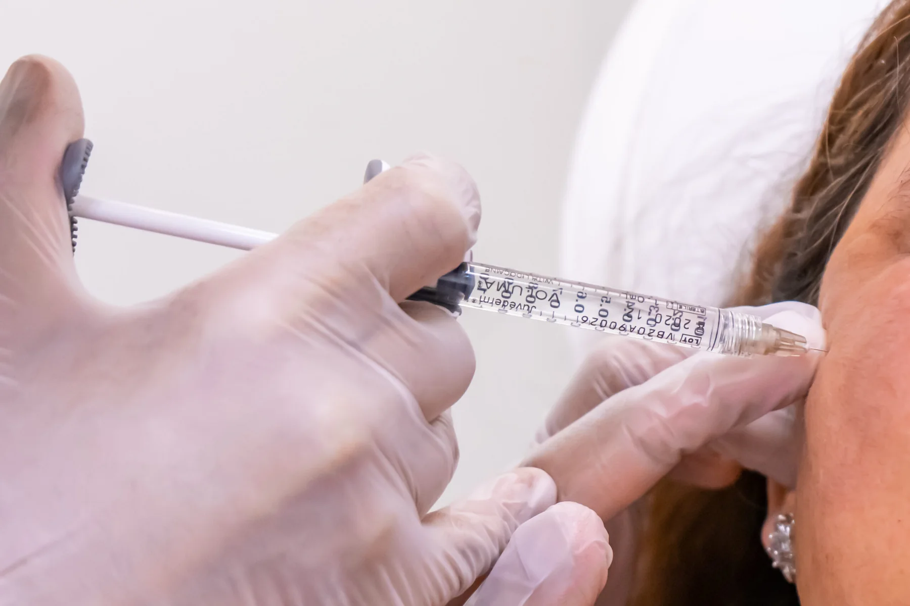 Is Spring the Best Time to Get Sculptra?